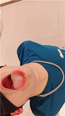 【萝莉收割机】袜子塞嘴精神小妹暴揍 bf59951