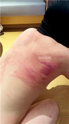 【毛绒月亮】护士姐姐藤条狠抽 bf60278
